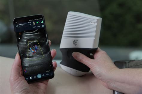 Bcit Alumnus Developed Portable Ultrasound Device Uses Home Grown