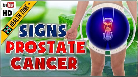 5 Early Signs And Symptoms Of Prostate Cancer You Should Not Ignore