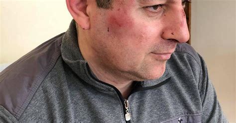 Russia Activist Attacked In Dagestan Human Rights Watch