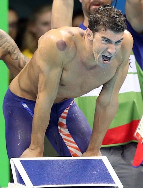 Those Weird Purple Circles On Michael Phelps Were From Cupping Gizmodo Australia