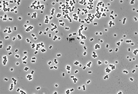 Staphylococcus Warneri E27 Dsm 30882 Bacdiveid14597