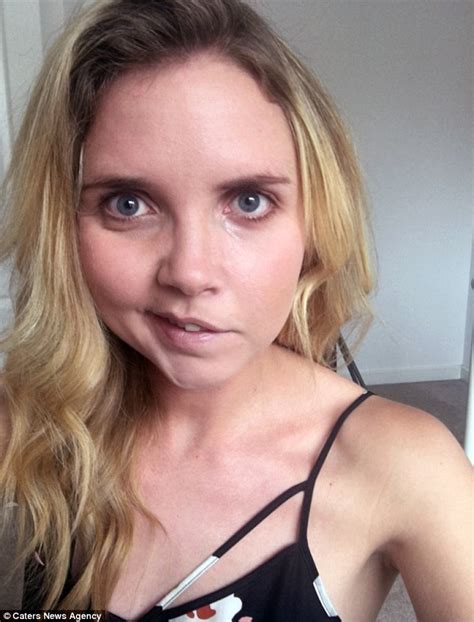 Woman Facially Paralysed By Bells Palsy Uses Selfies To Teach Herself