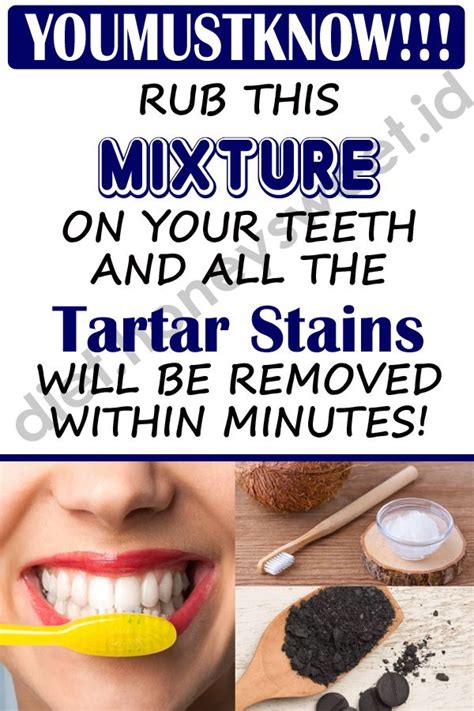 How To Whiten Teeth With Braces Stains Pin On Teeth Whitening How To