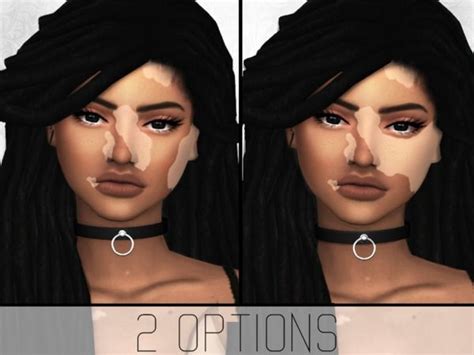 Simplypixelated Vitiligo Overlay The Sims 4 Skin Sims