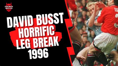 David Busst Horrific Leg Break 1996 YouTube