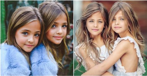 The World S Most Beautiful Twins Have Grown Up See What They Look Like Now Archynewsy