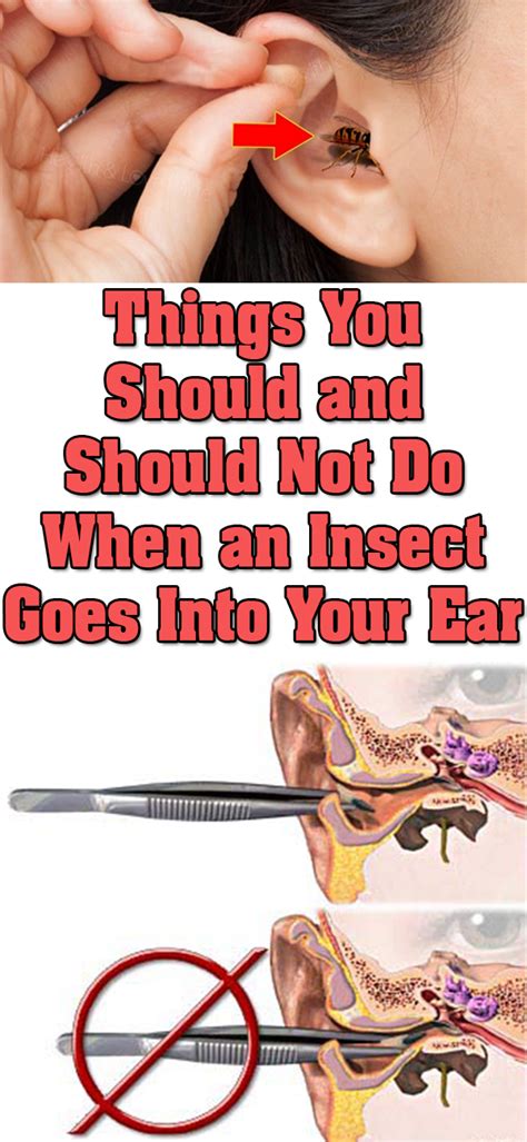 Things You Should And Should Not Do When An Insect Goes Into Your Ear