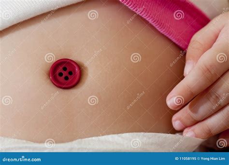 Granuloma Baby Belly Button