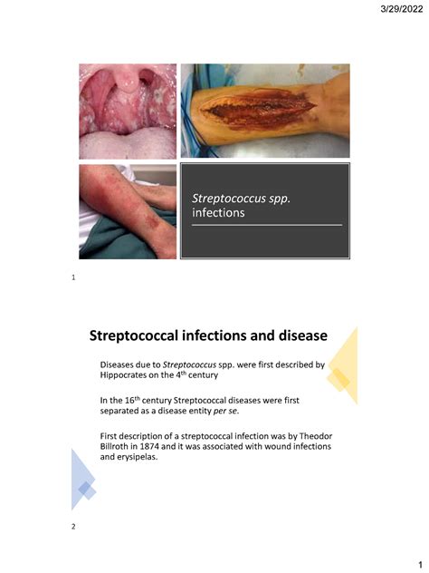 Streptococcus Infections 2 Slides Streptococcus Spp Infections Streptococcal Infections And