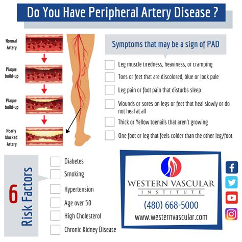 Peripheral Artery Disease Checklist Peripheral Artery Disease
