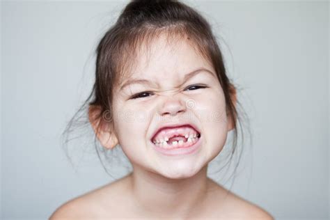 Portrait Of A Little Toothless Girl Stock Image Image Of Asian Dear