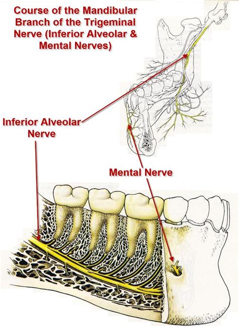 Dental Nerve Injuries Exodontia