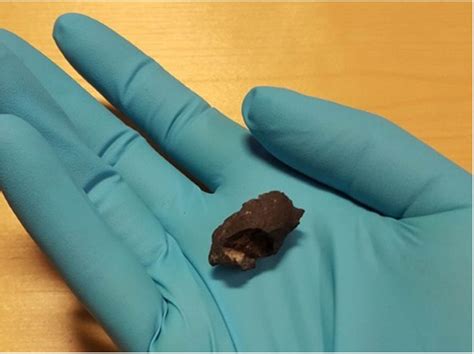 10000 Year Old Chewing Gum Reveals Early Scandinavian Dna Dentistry