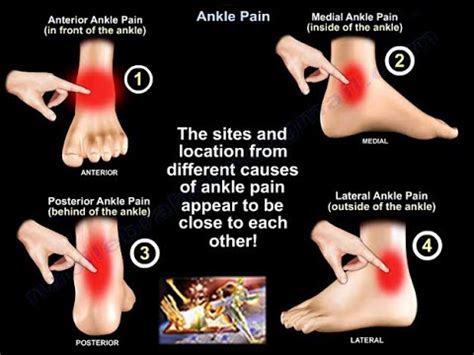 Ankle Pain Everything You Need To Know Dr Nabil Ebraheim Youtube