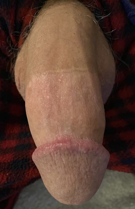 How Should My Penis Look Uncircumcised Best Porno 2020 Pics