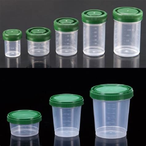 China Stserile Urine Sample Lab Container Pathology Specimen Container