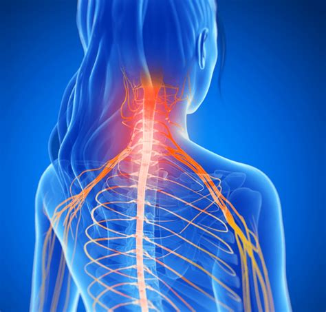 How To Fix A Pinched Nerve In The Neck Causes Symptom