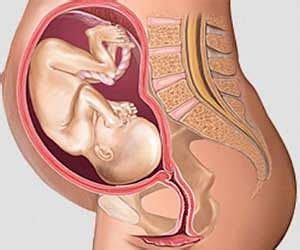 Woman With Two Uteruses Gives Birth To Twin Daughters One In Crore Women In The World Has