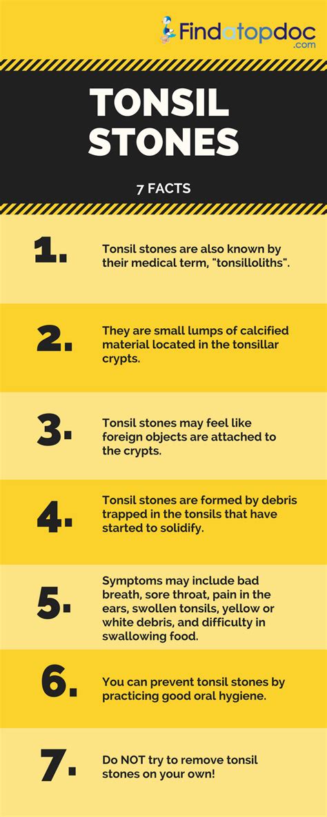 Tonsillitis Symptoms Causes Treatment And Diagnosis Findatopdoc