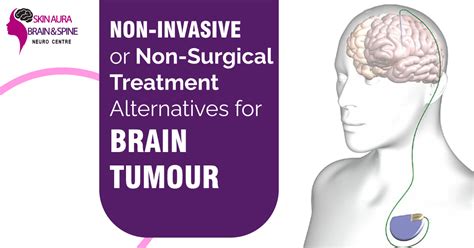 Brain Tumor Treatment Without Surgery Dr Vikas Kathuria