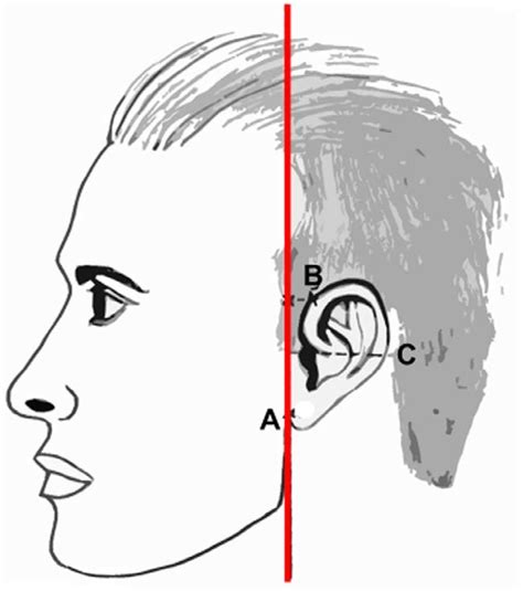 The Position Of The Ear In Profile View The Ear Lobe Vertical