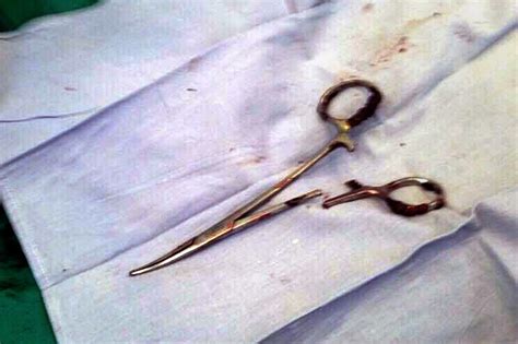 Scissors Pulled From Mans Stomach 18 Years After Surgery Abs Cbn News
