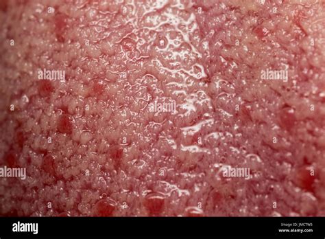 Macro Photo Of Taste Buds On Human Tongue Stock Photo Alamy
