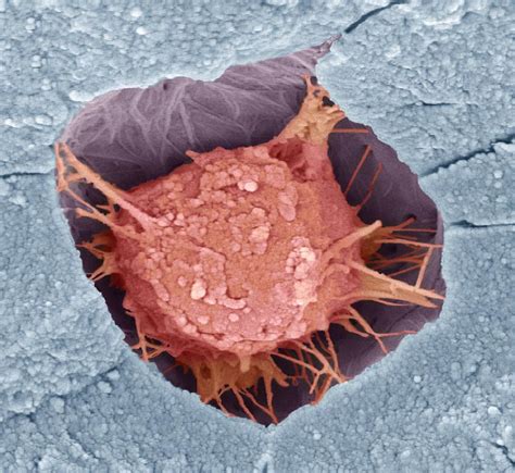Osteoblast Bone Cell Sem Photograph By Steve Gschmeissner Pixels
