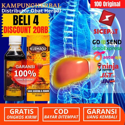 Jual Obat Liver Kronis Penyakit Kuning Hepatitis A B C Bengkak Hati