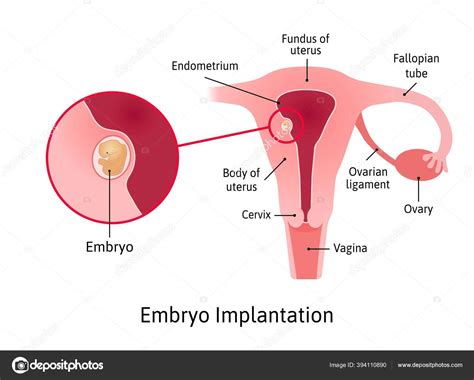 Implantation Stage Of Pregnancy When Embryo Adheres To The Wall Of The Uterus Parts Of Uterus