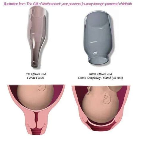 Cervix Dilation Chart Signs Stages And Procedure To Check Artofit