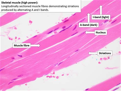 Skeletal Muscle Slide Labeled