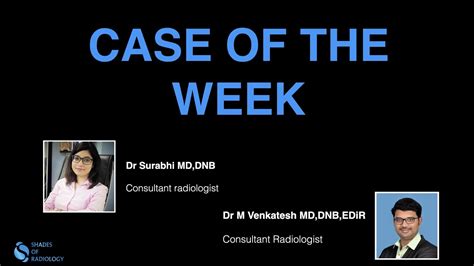 Case Of The Week By Dr Surabhi Youtube