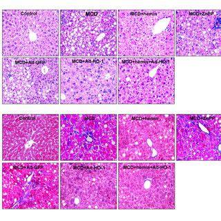 Histopathological Changes Of Liver Sections Of Mice Under Various