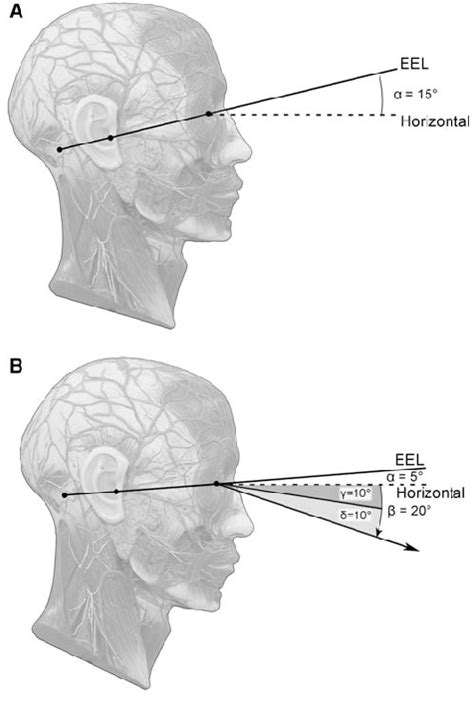 Flexion Of The Head And Viewing Direction A Neutral Position The