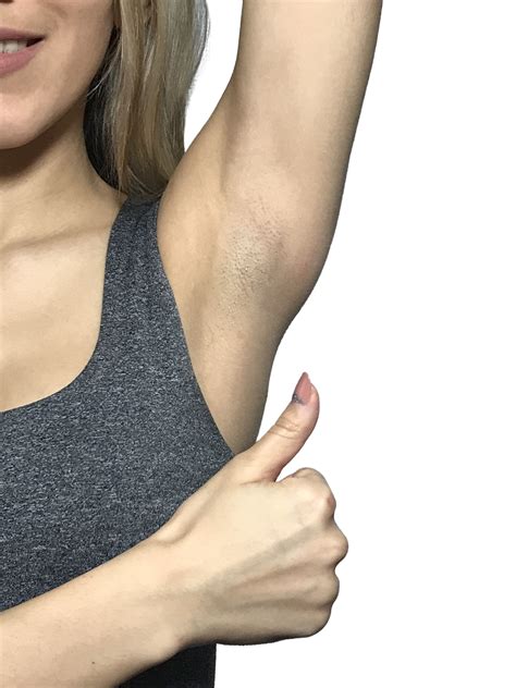 How To Lighten Armpits How To Get Rid Of Dark Underarms Top 10 Home