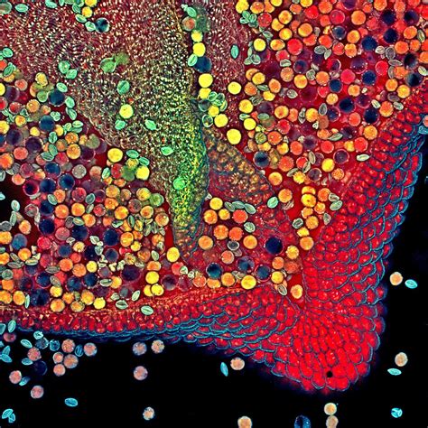 These Award Winning Photos Of The Microscopic World Will Blow Your Mind
