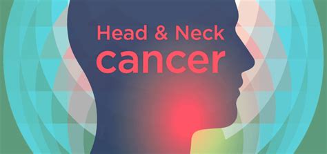 A New Risk Factor For Head Neck Cancers You Need To Know Shine365