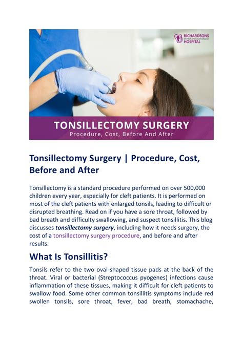 Ppt All That You Wanted To Learn More About Tonsillectomy Surgery