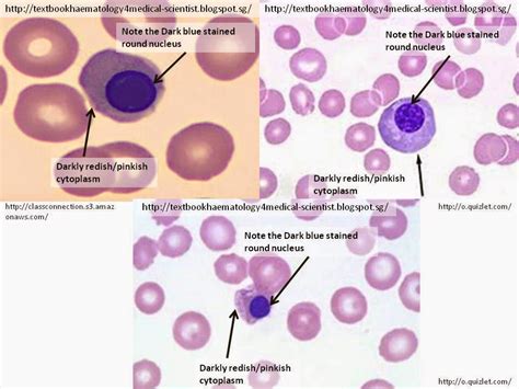 Wbc Correction For The Presence Of Nucleated Red Blood Cells بست لاب