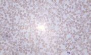 Maybe you would like to learn more about one of these? What Happens to Plant and Animal Cells When Placed in ...