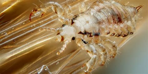 Does Uv Light Kill Head Lice Shelly Lighting