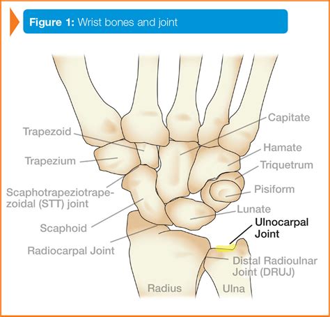 Ulnar Ligament Wrist