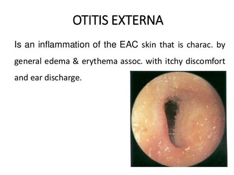 Diseases Of External Ear 1