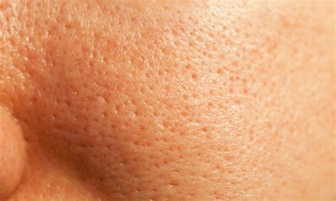 Here Are Six Truths And Myths About Pores You Need To Know Life