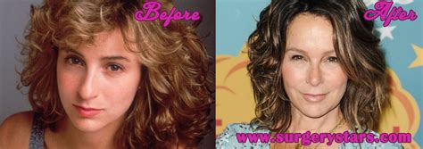 Jennifer Grey Before And After Picture