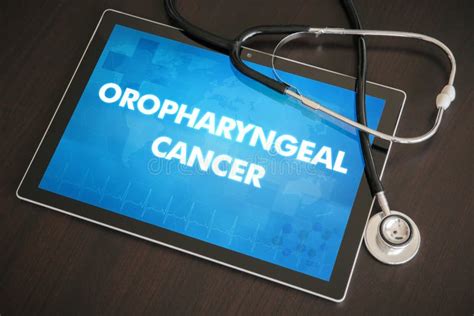 Oropharyngeal Cancer Cancer Type Diagnosis Medical Concept On Stock