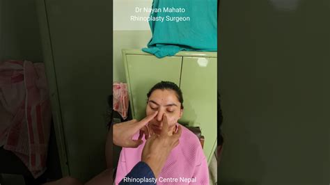 Nose Massage After Rhinoplasty Dr Nayan Mahato Nepal Youtube