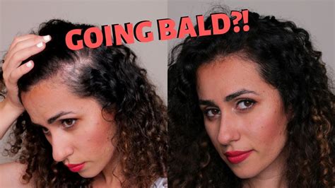 5 Genius Tricks To Cover Up Bald Patches Youtube