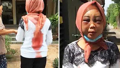 Rozita didakwa dengan sengaja menyebabkan kecederaan parah terhadap suyanti sutrinso dengan menggunakan sebilah pisau berhulu biru, sebatang pengelap lantai, sekaki payung, sebatang rod besi berwarna biru, sebatang alat mainan kucing dan penyangkut baju berwarna putih yang digunakan. Permohanan semakan hukuman Datin cederakan amah didengar ...